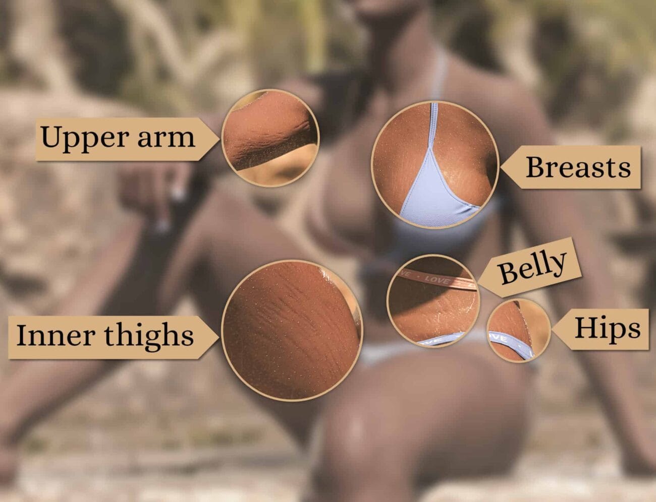 Stretch Marks for Genesis 9