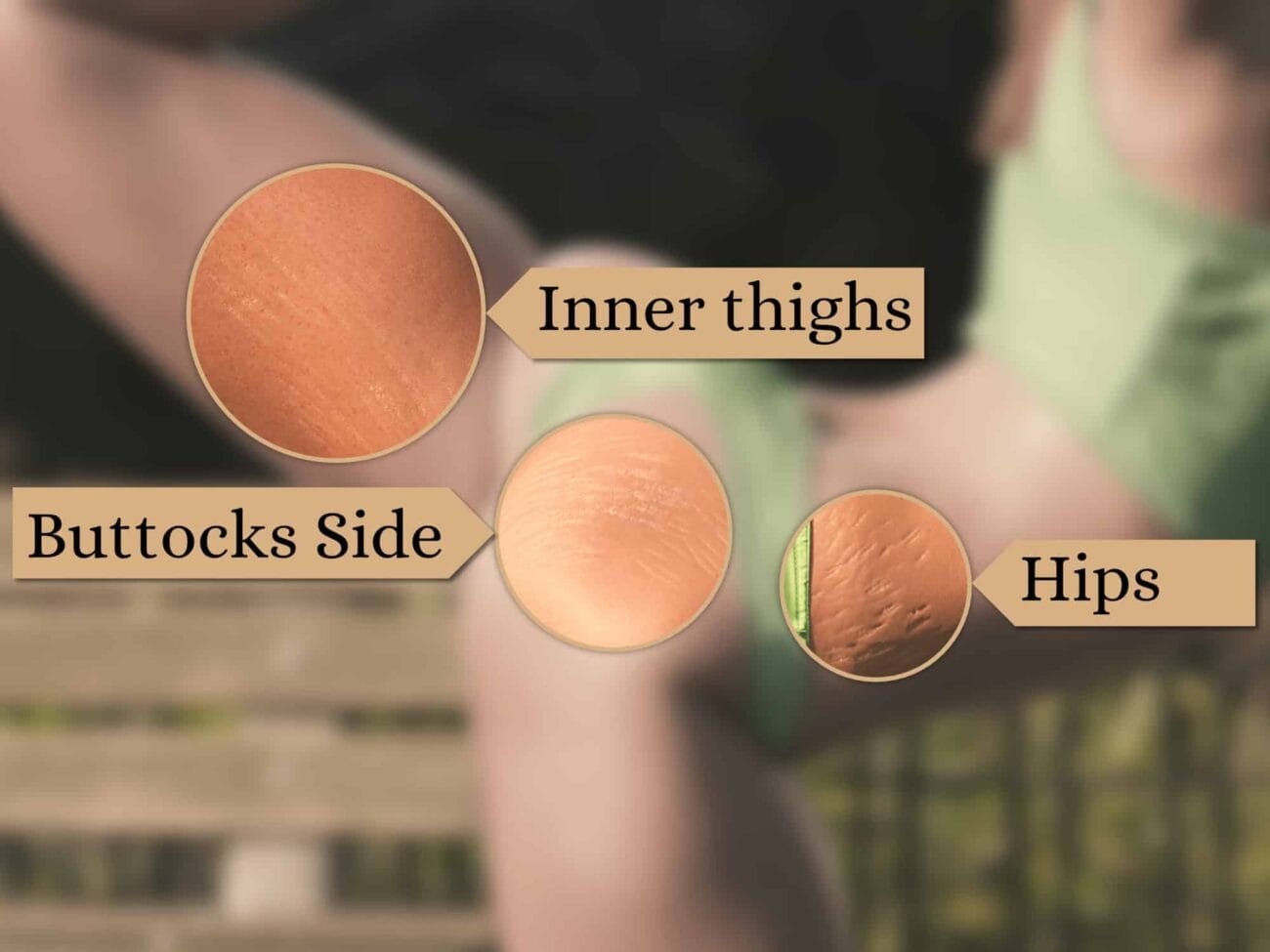 Stretch Marks for Genesis 9