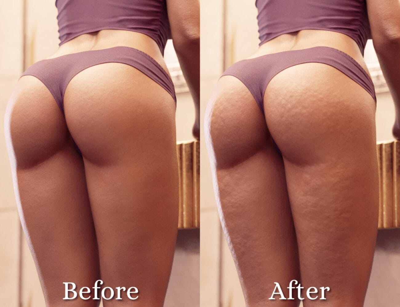Smooth, toned female legs and buttocks in purple athletic shorts, illustrating skin texture improvement before and after skin treatment, promoting high-quality 3D assets for realistic character modeling.